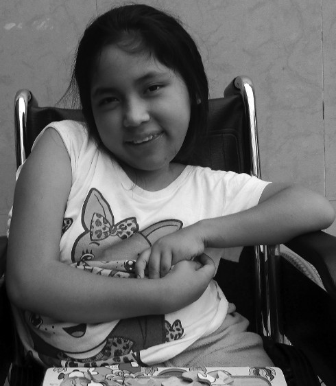 Maria – Severe Scoliosis-Dislocated Hips-Clubbed Feet | Villa La Paz ...